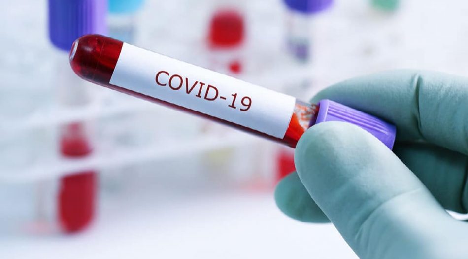 COVID-19(5)